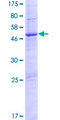 PTCHD1 Protein - 12.5% SDS-PAGE of human PTCHD1 stained with Coomassie Blue