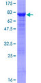 PTENP1 Protein - 12.5% SDS-PAGE of human PTENP1 stained with Coomassie Blue