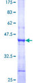 PTER Protein - 12.5% SDS-PAGE Stained with Coomassie Blue