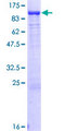 PUS7L Protein - 12.5% SDS-PAGE of human PUS7L stained with Coomassie Blue
