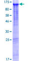 QRICH1 Protein - 12.5% SDS-PAGE of human QRICH1 stained with Coomassie Blue