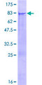 QRSL1 / GatA Protein - 12.5% SDS-PAGE of human QRSL1 stained with Coomassie Blue