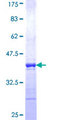 RAB19 Protein - 12.5% SDS-PAGE Stained with Coomassie Blue.