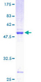 RAB29 / RAB7L1 Protein - 12.5% SDS-PAGE of human RAB7L1 stained with Coomassie Blue