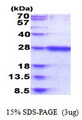 RAB39B Protein