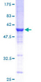 RAB3C Protein - 12.5% SDS-PAGE of human RAB3C stained with Coomassie Blue