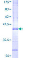 RAB40A / RAR2 Protein - 12.5% SDS-PAGE Stained with Coomassie Blue.
