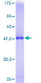 RAB7B Protein - 12.5% SDS-PAGE of human RAB7B stained with Coomassie Blue