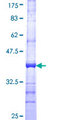 RAB7B Protein - 12.5% SDS-PAGE Stained with Coomassie Blue.