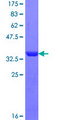RABEP1 / Rabaptin-5 Protein - 12.5% SDS-PAGE Stained with Coomassie Blue.