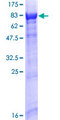 RABGGTA Protein - 12.5% SDS-PAGE of human RABGGTA stained with Coomassie Blue