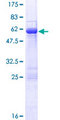RABGGTB Protein - 12.5% SDS-PAGE of human RABGGTB stained with Coomassie Blue