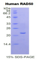 RAD50 Protein - Recombinant DNA Repair Protein RAD50 By SDS-PAGE