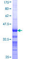 RAD9B Protein - 12.5% SDS-PAGE Stained with Coomassie Blue.