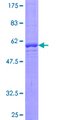 RALGPS2 Protein - 12.5% SDS-PAGE of human RALGPS2 stained with Coomassie Blue