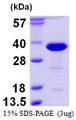 RANBP1 Protein