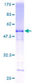 RAP30 / GTF2F2 Protein - 12.5% SDS-PAGE of human GTF2F2 stained with Coomassie Blue
