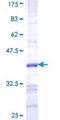 RASGEF1C Protein - 12.5% SDS-PAGE Stained with Coomassie Blue.
