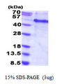 RBM13 / MAK16 Protein