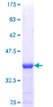 RBM17 Protein - 12.5% SDS-PAGE Stained with Coomassie Blue.