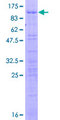 RBM39 Protein - 12.5% SDS-PAGE of human RNPC2 stained with Coomassie Blue