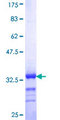 RBM39 Protein - 12.5% SDS-PAGE Stained with Coomassie Blue.