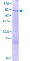 RBM42 Protein - 12.5% SDS-PAGE of human RBM42 stained with Coomassie Blue