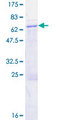 RBM4B Protein - 12.5% SDS-PAGE of human RBM4B stained with Coomassie Blue
