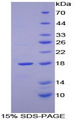 RBP2 / CRBPII Protein - Recombinant Retinol Binding Protein 2, Cellular By SDS-PAGE