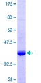 RCBTB2 Protein - 12.5% SDS-PAGE Stained with Coomassie Blue.