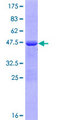 RCSD1 Protein - 12.5% SDS-PAGE of human RCSD1 stained with Coomassie Blue