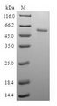 RD / PHYH Protein - (Tris-Glycine gel) Discontinuous SDS-PAGE (reduced) with 5% enrichment gel and 15% separation gel.