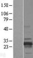 RD3 Protein - Western validation with an anti-DDK antibody * L: Control HEK293 lysate R: Over-expression lysate