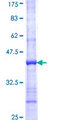 RDH1 / RDH5 Protein - 12.5% SDS-PAGE Stained with Coomassie Blue.