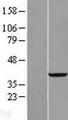 RDH14 Protein - Western validation with an anti-DDK antibody * L: Control HEK293 lysate R: Over-expression lysate