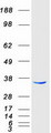 RDH14 Protein - Purified recombinant protein RDH14 was analyzed by SDS-PAGE gel and Coomassie Blue Staining