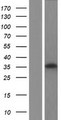 RDH16 Protein - Western validation with an anti-DDK antibody * L: Control HEK293 lysate R: Over-expression lysate
