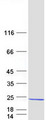 REEP6 Protein - Purified recombinant protein REEP6 was analyzed by SDS-PAGE gel and Coomassie Blue Staining