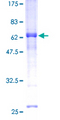 REM1 / REM-1 Protein - 12.5% SDS-PAGE of human REM1 stained with Coomassie Blue