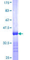 REM1 / REM-1 Protein - 12.5% SDS-PAGE Stained with Coomassie Blue.