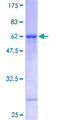 RFC2 / RFC40 Protein - 12.5% SDS-PAGE of human RFC2 stained with Coomassie Blue