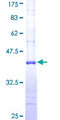 RFC3 Protein - 12.5% SDS-PAGE Stained with Coomassie Blue.
