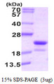 RFK Protein