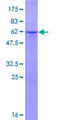RFPL1 Protein - 12.5% SDS-PAGE of human RFPL1 stained with Coomassie Blue