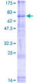 RFT1 Protein - 12.5% SDS-PAGE of human RFT1 stained with Coomassie Blue