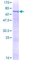 RGL4 Protein - 12.5% SDS-PAGE of human Rgr stained with Coomassie Blue