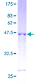 RGS17 / RGSZ2 Protein - 12.5% SDS-PAGE of human RGS17 stained with Coomassie Blue