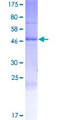 RHBDD2 Protein - 12.5% SDS-PAGE of human RHBDD2 stained with Coomassie Blue