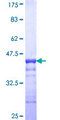RHBDL1 Protein - 12.5% SDS-PAGE Stained with Coomassie Blue.