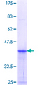RHBDL2 / RRP2 Protein - 12.5% SDS-PAGE Stained with Coomassie Blue.